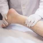 Foot & Ankle Injuries in Miami: When to Rest vs. When to See a Surgeon